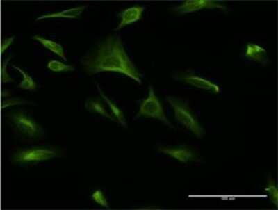 Immunocytochemistry/ Immunofluorescence: ATF6 beta Antibody (4D10) [H00001388-M02]