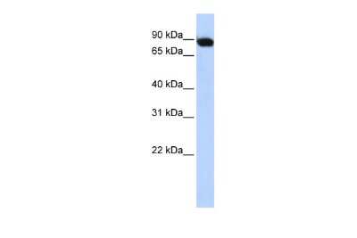 Western Blot: ATF6 beta Antibody [NBP2-84474]