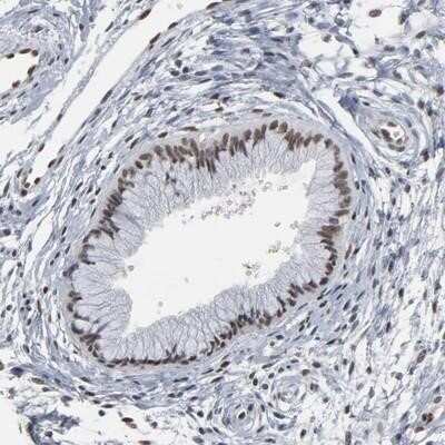 Immunohistochemistry-Paraffin: ATF7 Antibody [NBP1-88876]