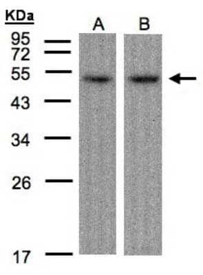 Western Blot: ATF7 Antibody [NBP1-30899]