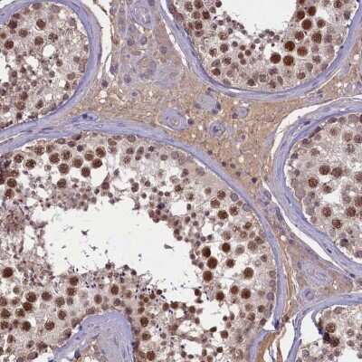 Immunohistochemistry-Paraffin: ATF7IP2 Antibody [NBP1-94028]