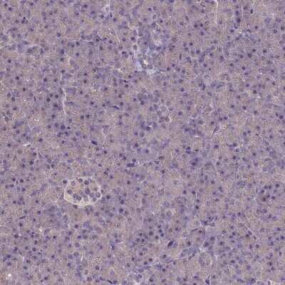 Immunohistochemistry-Paraffin: ATF7IP2 Antibody [NBP1-94028]