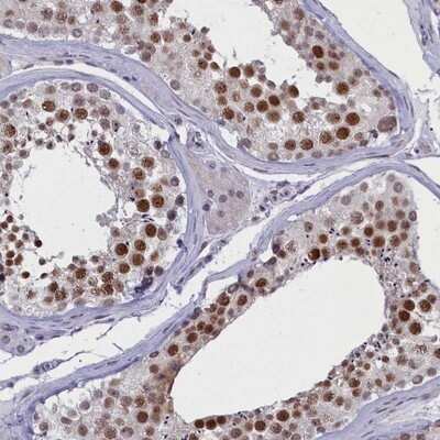 Immunohistochemistry-Paraffin: ATF7IP2 Antibody [NBP1-94029]