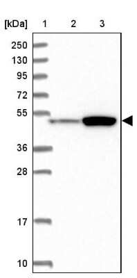 Western Blot: ATF7IP2 Antibody [NBP1-94029]