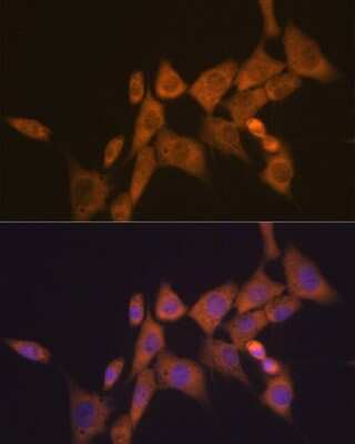 Immunocytochemistry/ Immunofluorescence: ATG10 Antibody (2Q3Q3) [NBP3-16649]
