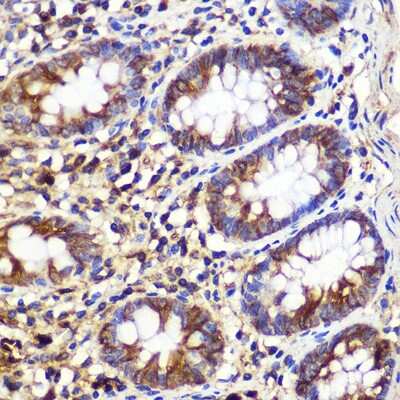 Immunohistochemistry-Paraffin: ATG10 Antibody - Azide and BSA Free [NBP2-92493]