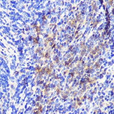 Immunohistochemistry-Paraffin: ATG10 Antibody - Azide and BSA Free [NBP2-92493]