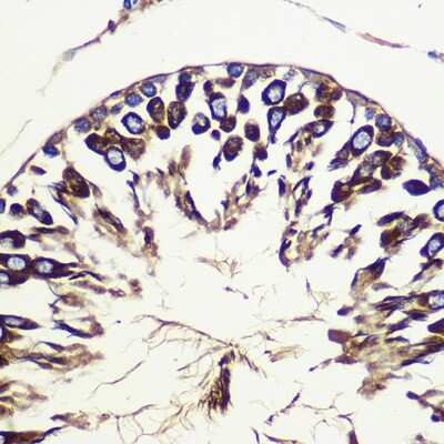 Immunohistochemistry-Paraffin: ATG10 Antibody - Azide and BSA Free [NBP2-92493]