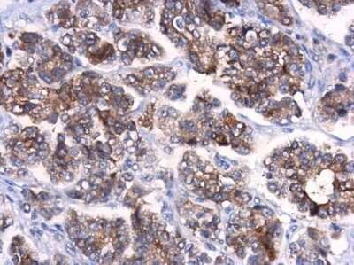 Immunohistochemistry-Paraffin: ATG10 Antibody [NBP3-13109]
