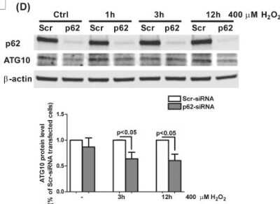 Western Blot: ATG10 Antibody [NBP2-38524]