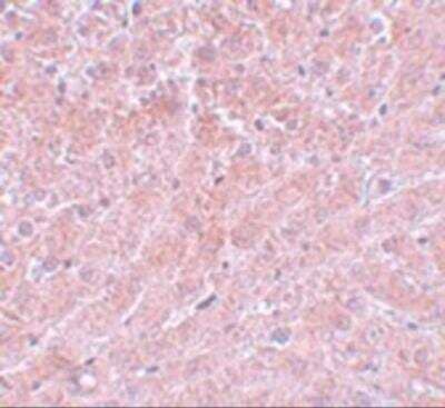Immunohistochemistry: ATG101 Antibody - BSA Free [NBP2-81705]