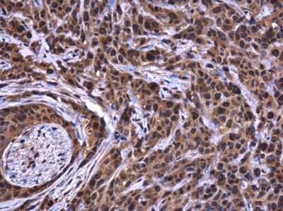 Immunohistochemistry-Paraffin: ATG101 Antibody [NBP3-13107]