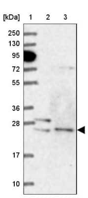 Western Blot: ATG101 Antibody [NBP1-88877]