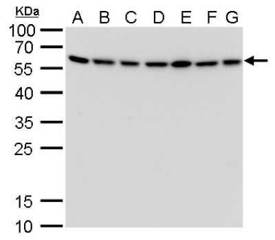 Western Blot: ATG12 Antibody (166) [NBP2-43781]