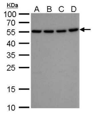 Western Blot: ATG12 Antibody (9411) [NBP2-43753]