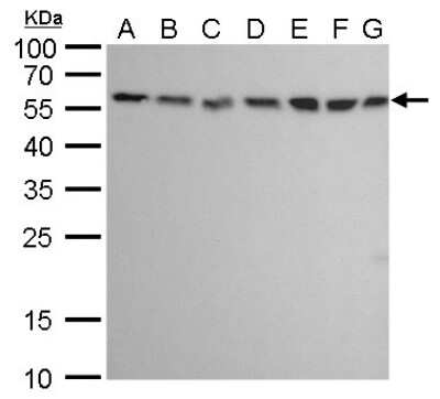 Western Blot: ATG12 Antibody (9411) [NBP2-43753]