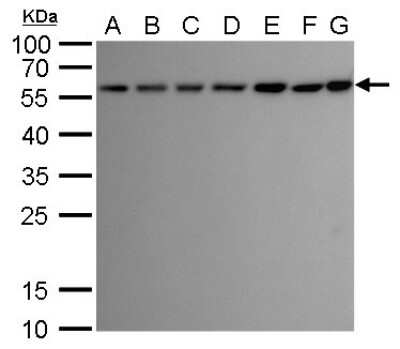 Western Blot: ATG12 Antibody (948) [NBP2-43752]