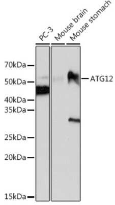 Western Blot: ATG12 Antibody (9R8W2) [NBP3-15812]