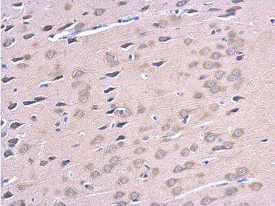 Immunohistochemistry-Paraffin: ATG12 Antibody [NBP2-15501]