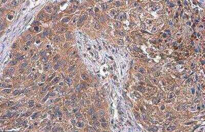 Immunohistochemistry-Paraffin: ATG12 Antibody [NBP2-15501]