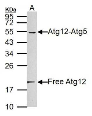 Western Blot: ATG12 Antibody [NBP2-15501]
