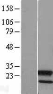 Western Blot: ATG12 Overexpression Lysate [NBL1-07795]