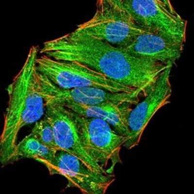 Immunocytochemistry/ Immunofluorescence: ATG13 Antibody (3E4C8) - BSA Free [NBP2-52419]