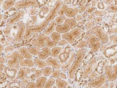 Immunohistochemistry-Paraffin: ATG13 Antibody [NBP3-06022]