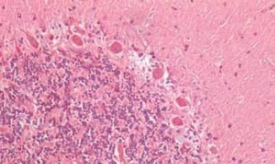 Immunohistochemistry-Paraffin: ATG16L1 Antibody [NBP3-14543]