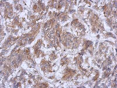 Immunohistochemistry-Paraffin: ATG16L1 Antibody [NBP2-15504]