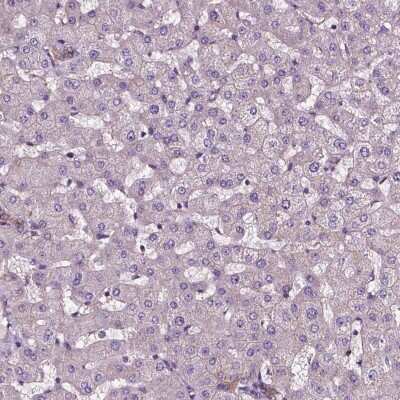 Immunohistochemistry-Paraffin: ATG16L1 Antibody [NBP2-49408]