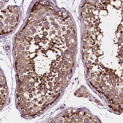 Immunohistochemistry-Paraffin: ATG16L1 Antibody [NBP2-49408]