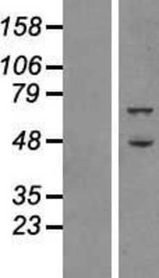 Western Blot: ATG16L1 Overexpression Lysate [NBP2-06180]