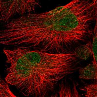 Immunocytochemistry/ Immunofluorescence: ATG16L2 Antibody [NBP2-58308]