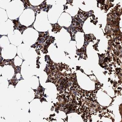 Immunohistochemistry-Paraffin: ATG2A Antibody [NBP1-83009]