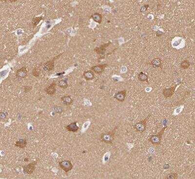 Immunohistochemistry-Paraffin: ATG2B Antibody [NBP1-90732]