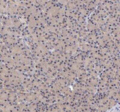 Immunohistochemistry-Paraffin: ATG2B Antibody [NBP1-90732]
