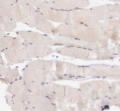 Immunohistochemistry-Paraffin: ATG2B Antibody [NBP1-90732]
