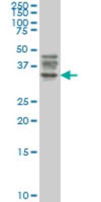 Western Blot: ATG3/APG3 Antibody (1F7) [H00064422-M06]