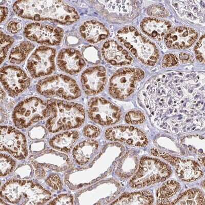 Immunohistochemistry: ATG3/APG3 Antibody [NBP2-37894]