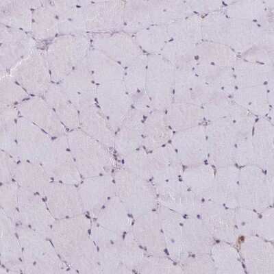 Immunohistochemistry-Paraffin: ATG3/APG3 Antibody [NBP2-37894]
