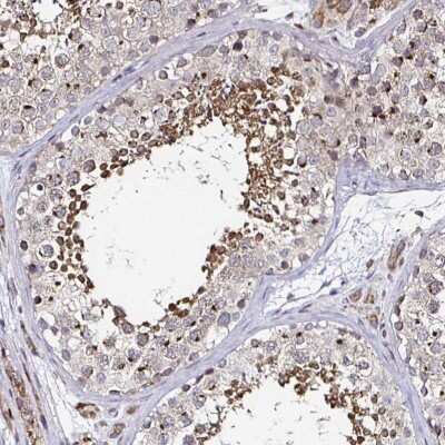 Immunohistochemistry-Paraffin: ATG3/APG3 Antibody [NBP2-37894]