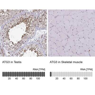 Immunohistochemistry-Paraffin: ATG3/APG3 Antibody [NBP2-37894]