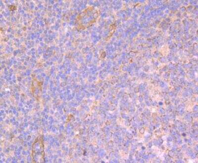 Immunohistochemistry-Paraffin: ATG3/APG3 Antibody [NBP3-09060]