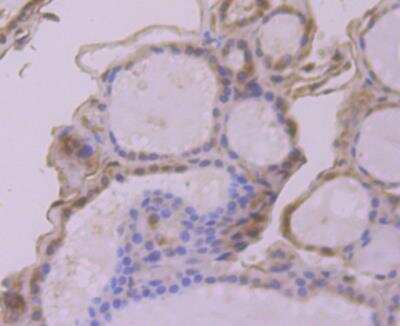 Immunohistochemistry-Paraffin: ATG3/APG3 Antibody [NBP3-09060]