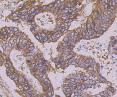 Immunohistochemistry-Paraffin: ATG3/APG3 Antibody [NBP3-09060]