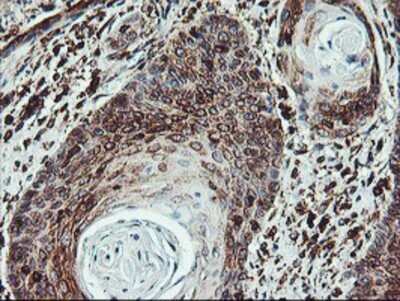 Immunohistochemistry: ATG3/APG3 Antibody (OTI3H2) - Azide and BSA Free [NBP2-72140]
