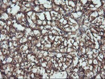 Immunohistochemistry: ATG3/APG3 Antibody (OTI3H2) - Azide and BSA Free [NBP2-72140]