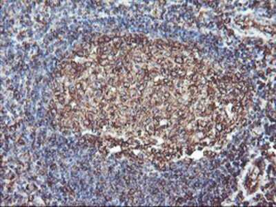Immunohistochemistry: ATG3/APG3 Antibody (OTI3H2) - Azide and BSA Free [NBP2-72140]