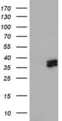 Western Blot: ATG3/APG3 Antibody (OTI3H2)Azide and BSA Free [NBP2-72140]